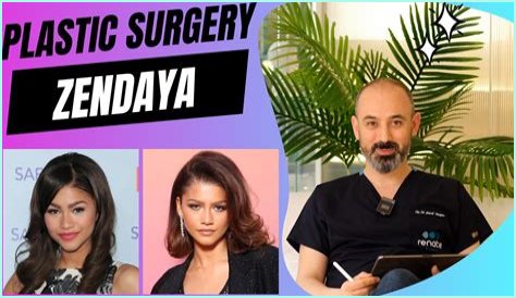Unveiling The Truth: Zendaya's Plastic Surgery Journey